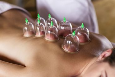 Cuppingmassage